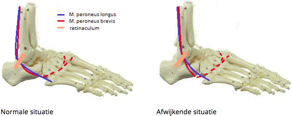 Afwijking van de botstructuur